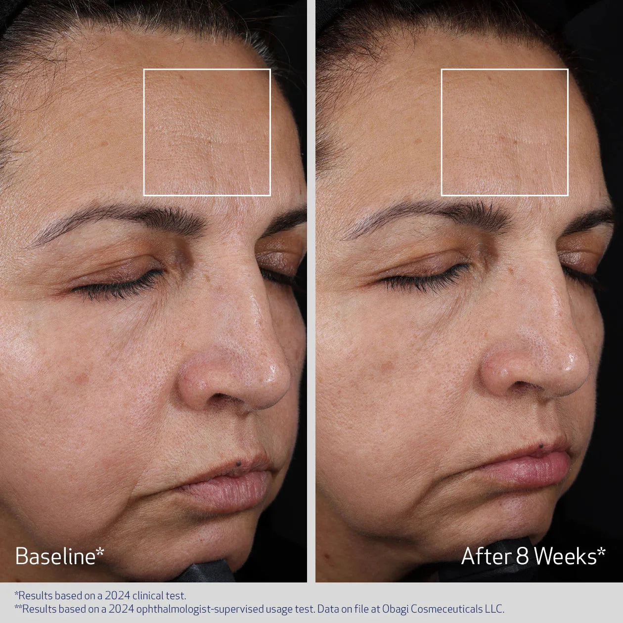 Before and after comparison of a woman's face with visible skin texture changes over 8 weeks.