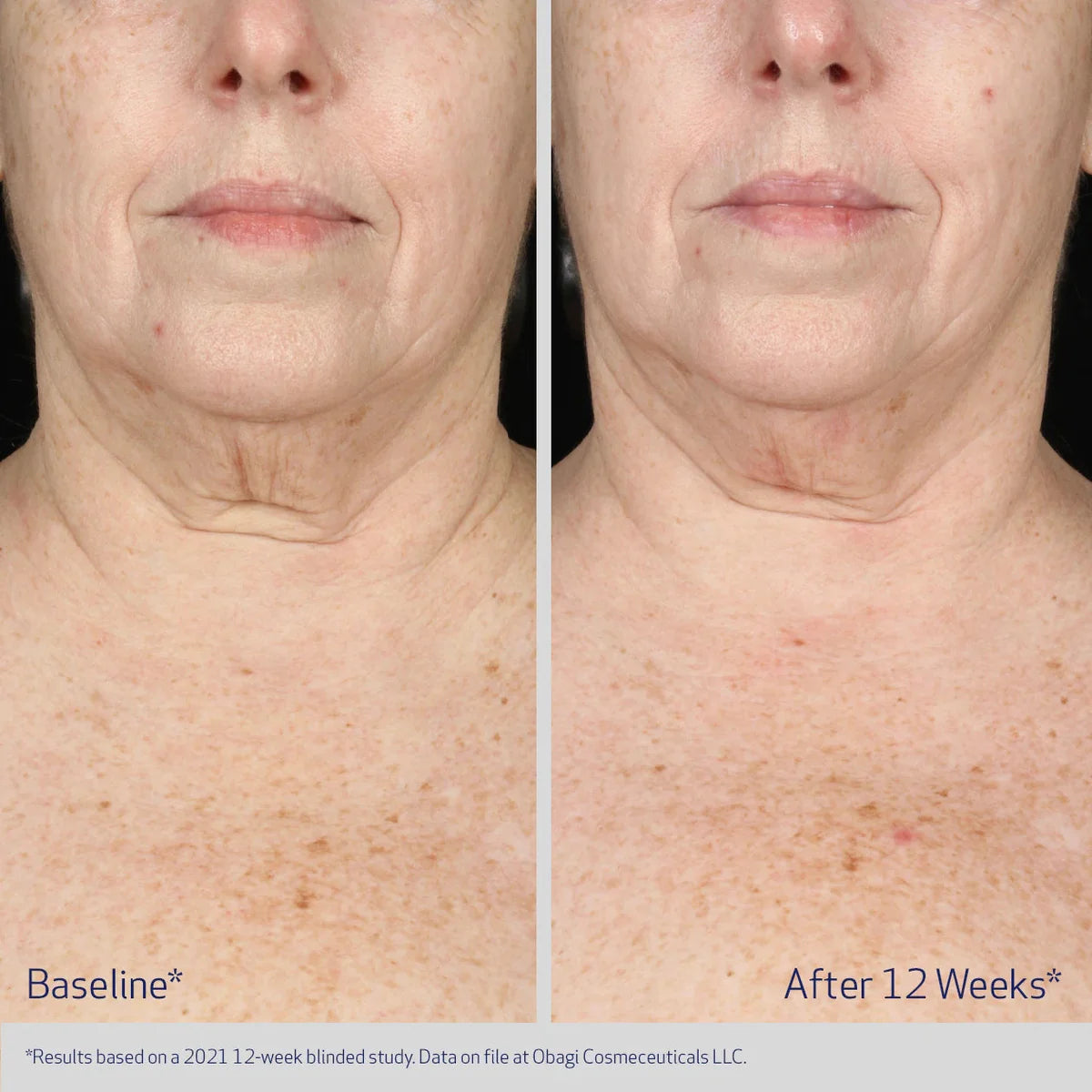 OBAGI Elastiderm Neck and Décolleté Concentrate 60 mL