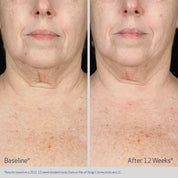 OBAGI Elastiderm Neck and Décolleté Concentrate 60 mL