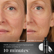Before and after comparison of a woman's face with visible wrinkles, showing clinical improvement with a Medik8 Liquid Peptides Advanced MP product.
