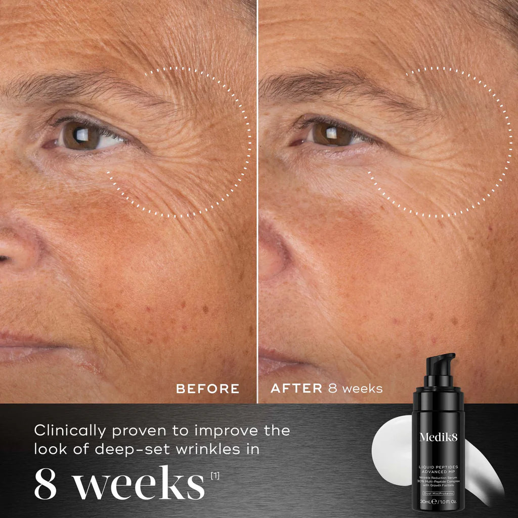 Before and after comparison of skin with deep-set wrinkles, showing a Medik8 Liquid Peptides Advanced MP product.