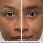 Before and after comparison of a person's eye area with Obagi Cosmeceuticals branding.