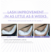 Eyelash improvement before and after images with text indicating results in 8 weeks.