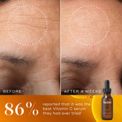 Before and after images of Medik8 C-Tetra Luxe serum 