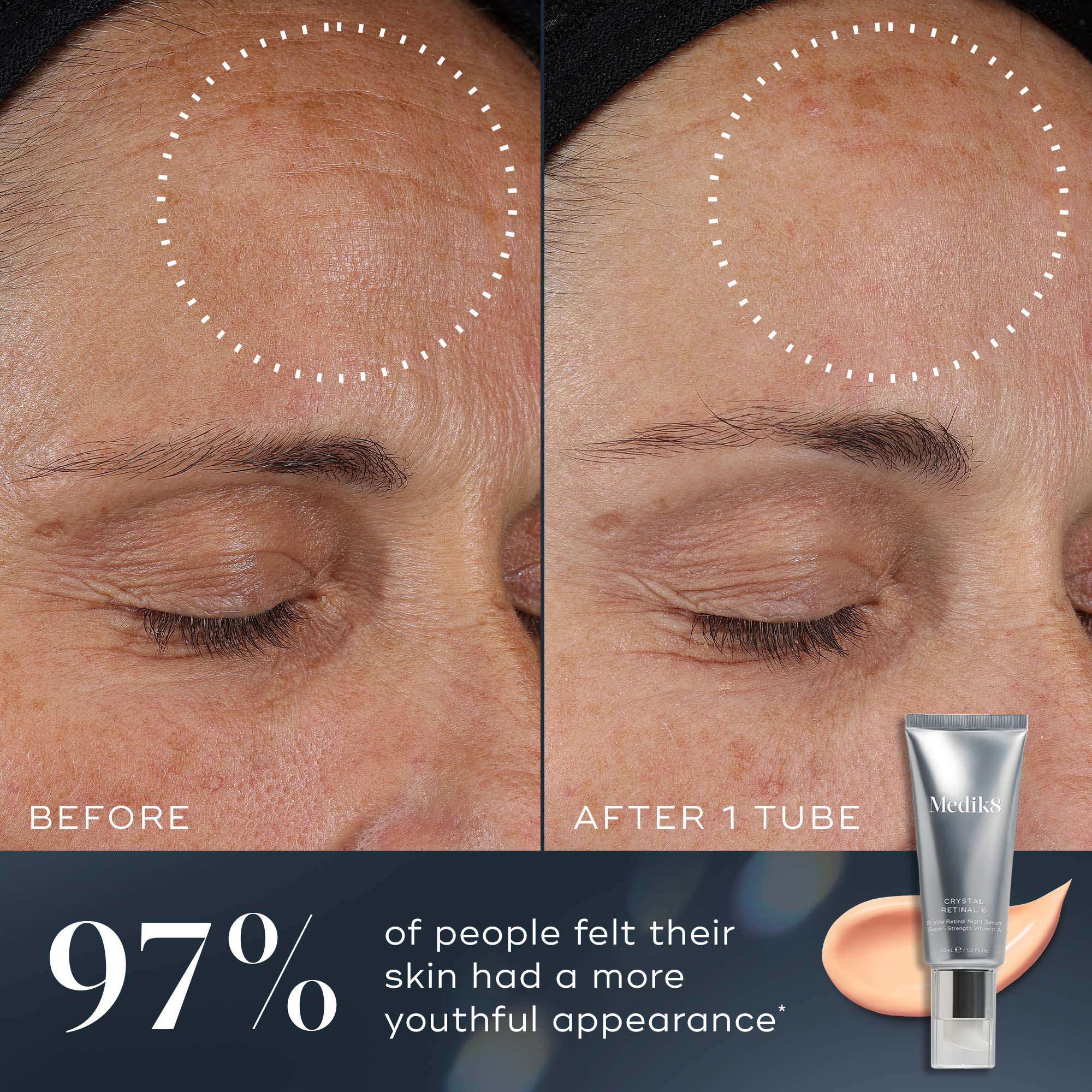 Before and after images of Medik8 Crystal Retinal face serum