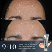 Before and after images of Medik8 Crystal Retinal face serum