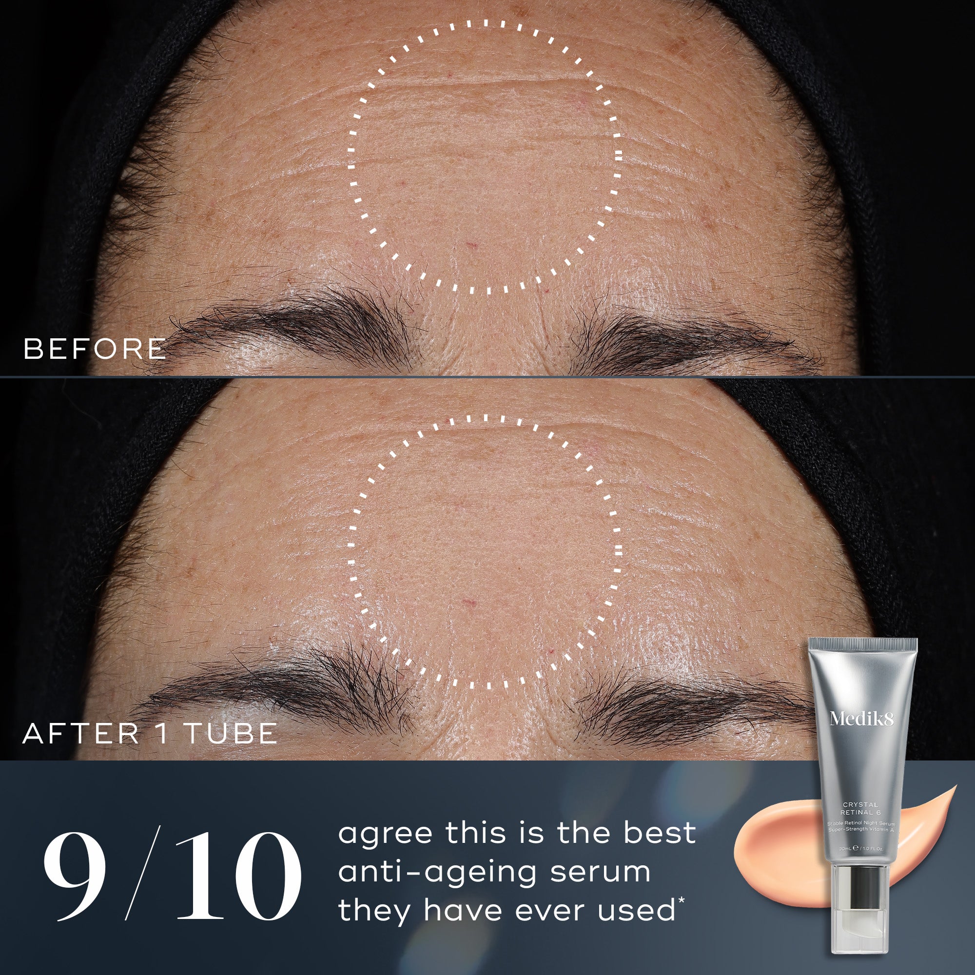 Before and after images of Medik8 Crystal Retinal face serum