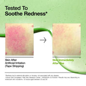 Before and after comparison of skin redness with a green background