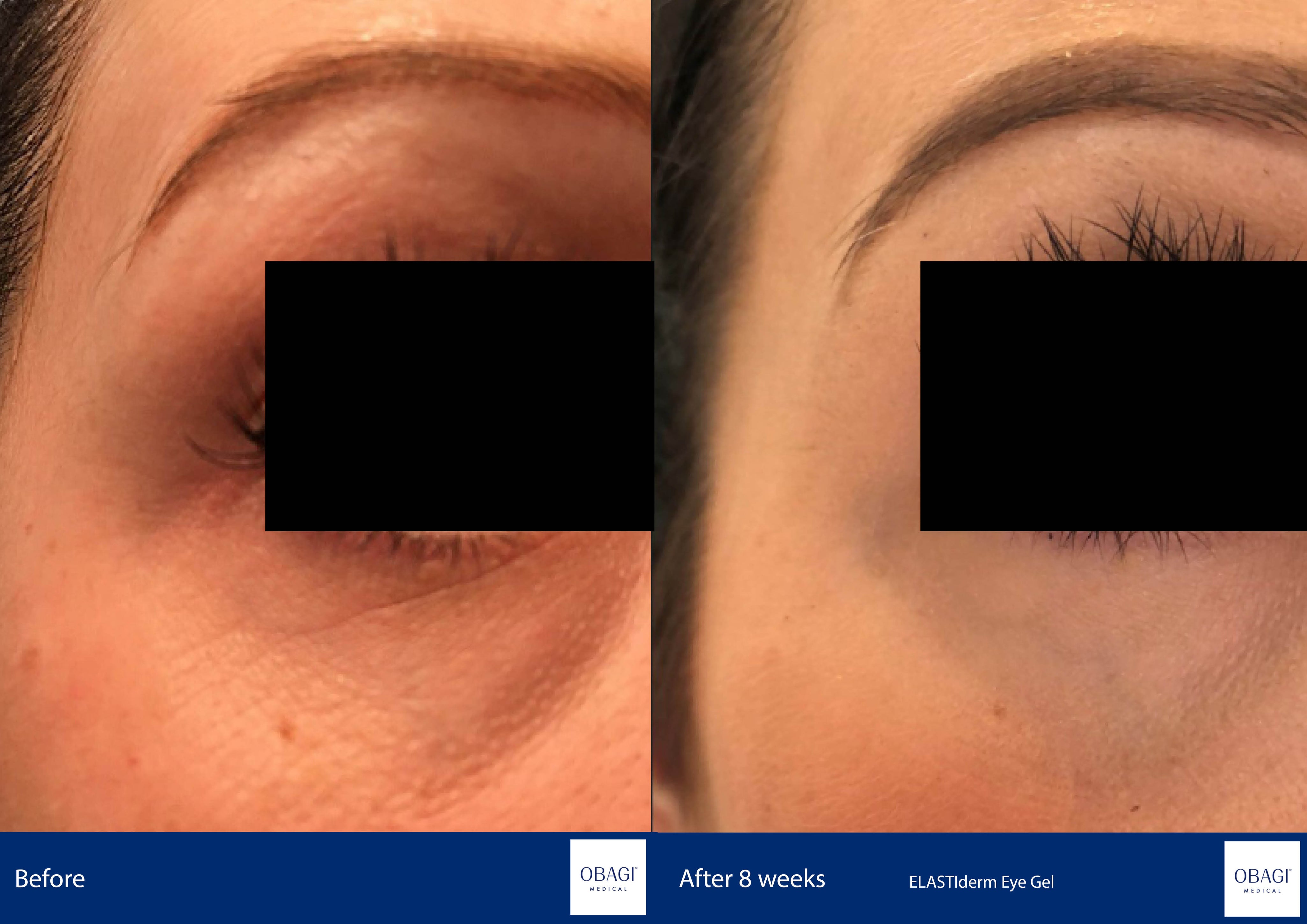 OBAGI ELASTIderm Eye Complete Complex Serum 14ml