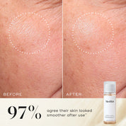Before and after images of Medik8 Press & Glow daily exfoliating PHA tonic