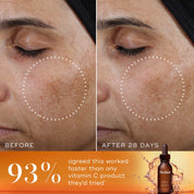 Before and after images of  Medik8  Super C Ferulic serum 