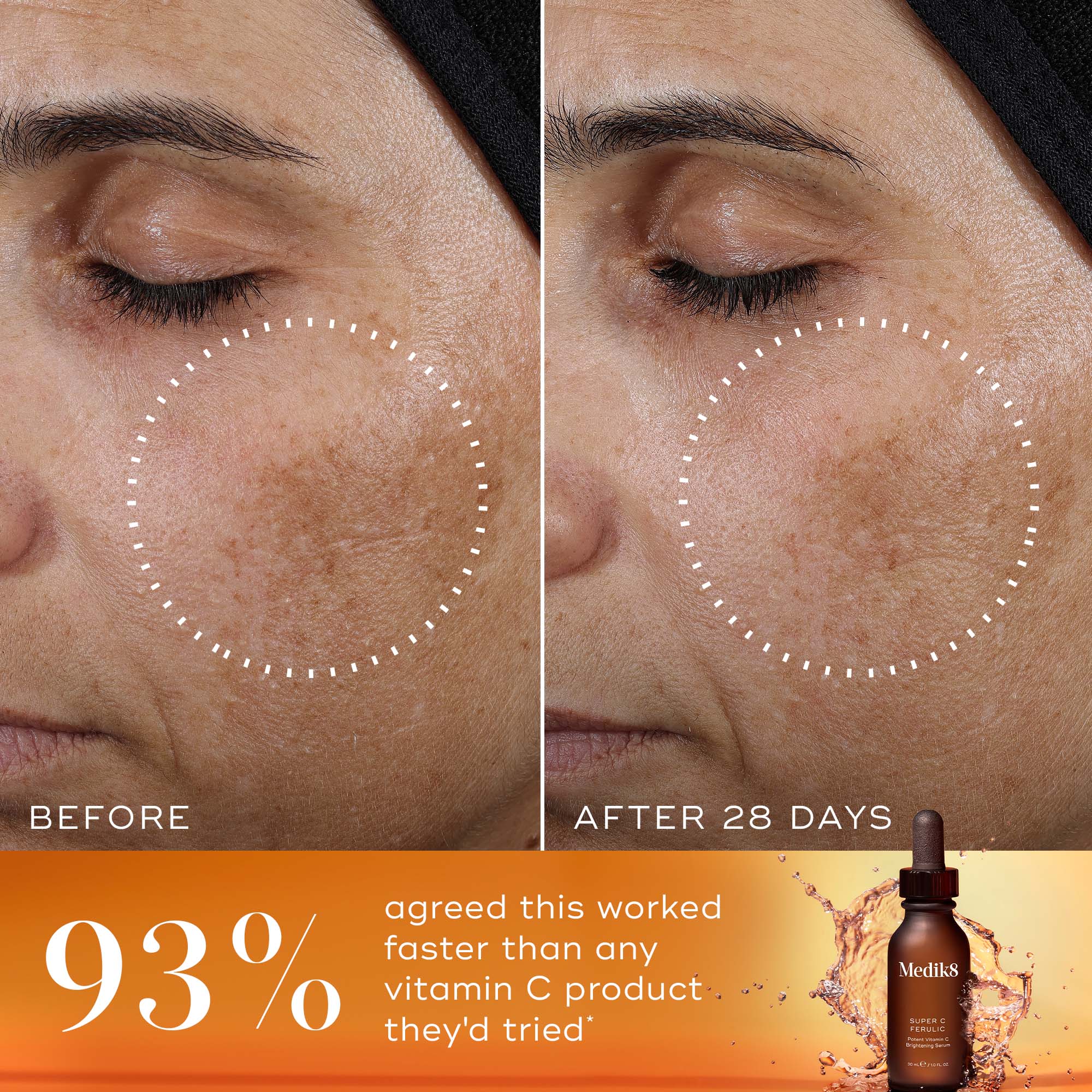 Before and after images of  Medik8  Super C Ferulic serum 