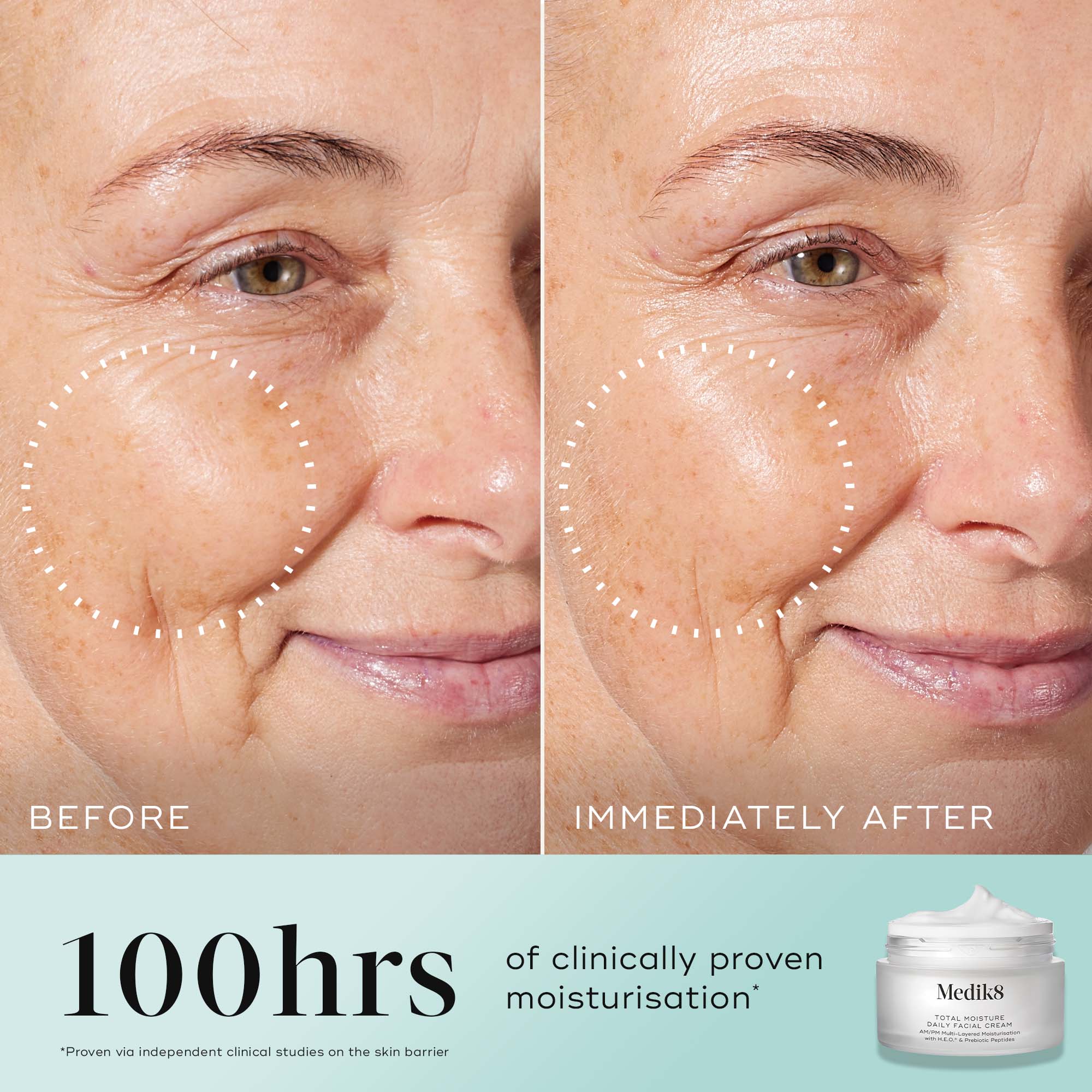 Medik8 Total Moisture Daily Facial Cream before and after images 